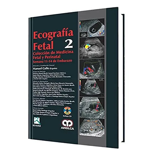 Portada de Ecografía fetal: semana 11-14 de embarazo, volumen 2