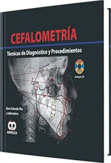 Portada de Cefalometría técnicas de diagnóstico y procedimientos