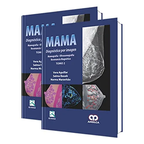 Portada de Mama diagnóstico por imagen mamografía, ultrasonografía, resonancia magnética