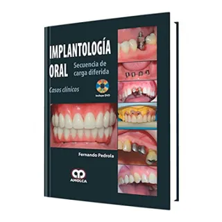 Portada de Implantologia oral secuencia de carga diferida, casos clinicos
