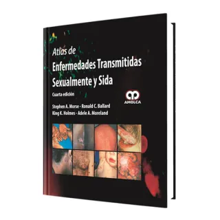 Portada de Atlas de enfermedades transmitidas sexualmente y sida