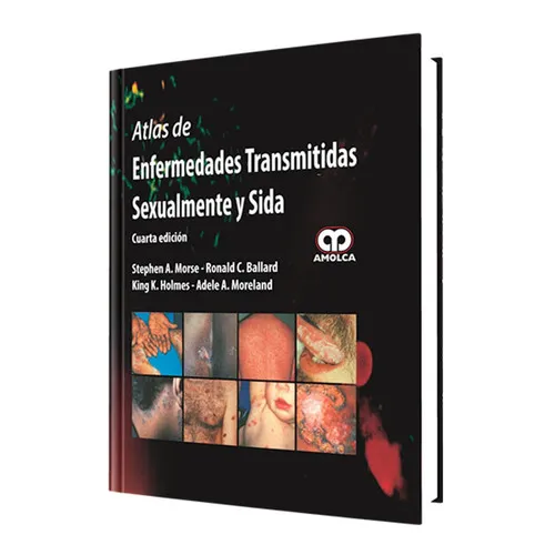 Portada de Atlas de enfermedades transmitidas sexualmente y sida