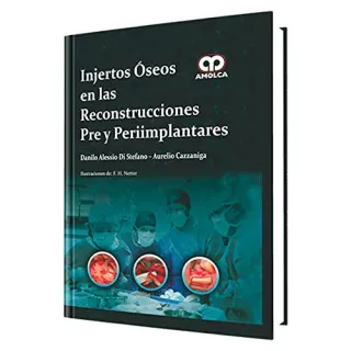 Portada de Injertos óseos en las reconstrucciones pre y peri-implantares