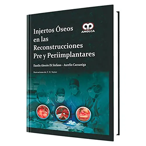 Portada de Injertos óseos en las reconstrucciones pre y peri-implantares