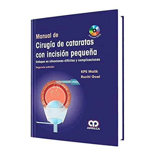 Portada de Manual de cirugía de cataratas con incisión pequeña: enfoque en situaciones difíciles y complicaciones