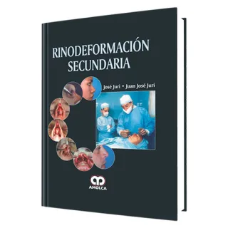 Portada de Rinodeformación Secundaria (Spanish Edition)