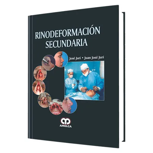 Portada de Rinodeformación Secundaria (Spanish Edition)