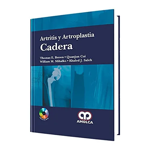 Portada de Artritis y Artroplastia de Cadera