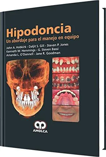 Portada de Hipodoncia un abordaje para el manejo en equipo
