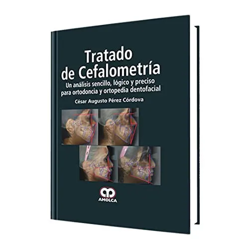 Portada de Tratado de Cefalometría (Spanish Edition)