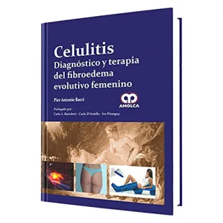 Portada de Celulitis. Diagnóstico y terapia del fibroedema evolutivo femenino (Spanish Edition)