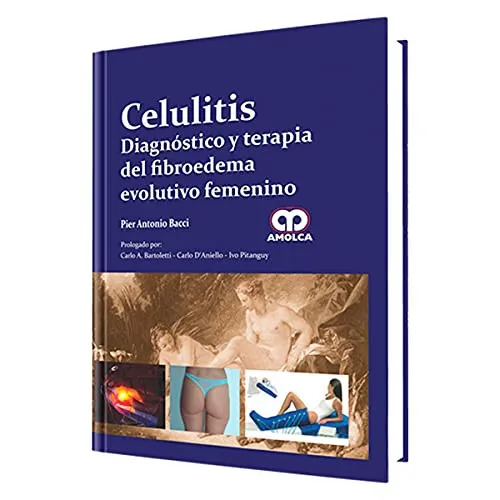 Portada de Celulitis. Diagnóstico y terapia del fibroedema evolutivo femenino (Spanish Edition)