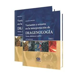 Portada de Variantes y errores en la interpretación de imageonología tórax, abdomen y pelvis