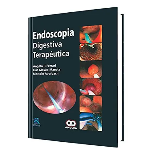 Portada de Endoscopía digestiva terapéutica