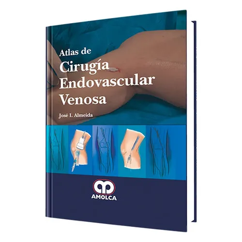 Portada de Atlas de cirugía endovascular venosa