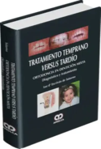 Portada de Tratamiento temprano versus tardío ortodoncia en dentición mixma : diagnóstico y tratamiento