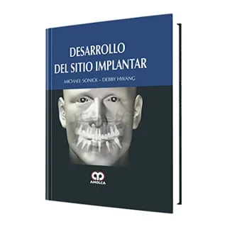Portada de Desarrollo del sitio implantar