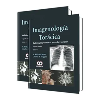 Portada de Imagenología Torácica Radiología Pulmonar Y Cardiovascular