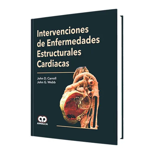 Portada de Intervenciones de Enfermedades Estructurales Cardiacas
