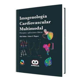 Portada de Imagenología cardiovascular multimodal. Principios y aplicaciones clínicas (Spanish Edition)