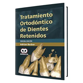 Portada de Tratamiento ortodóntico de dientes retenidos