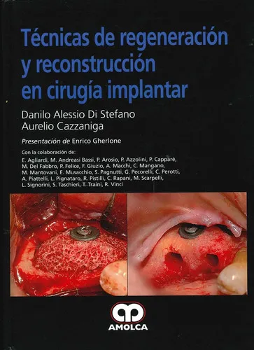 Portada de Técnicas de regeneración y reconstrucción en cirugía implantar