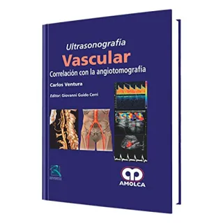 Portada de Ultrasonografía vascular. Correlación con la angiotomografía (Spanish Edition)