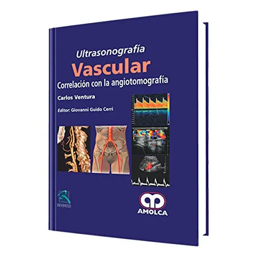 Portada de Ultrasonografía vascular. Correlación con la angiotomografía (Spanish Edition)