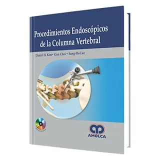 Portada de Procedimientos Endoscópicos de la Columna Vertebral (Spanish Edition)