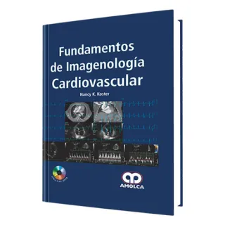 Portada de Fundamentos de imagenología cardiovascular (Spanish Edition)