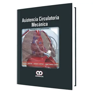 Portada de Asistencia circulatoria mecánica (Spanish Edition)