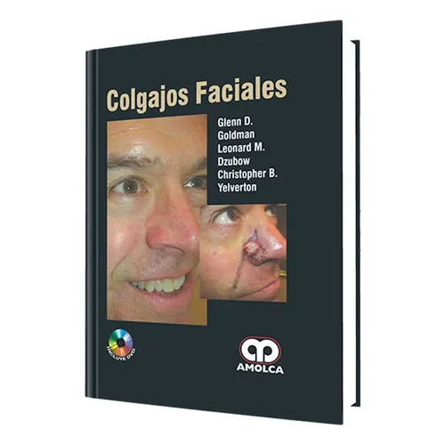 Portada de Colgajos faciales
