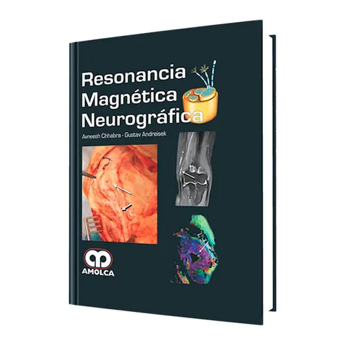 Portada de Resonancia magnética neurográfica