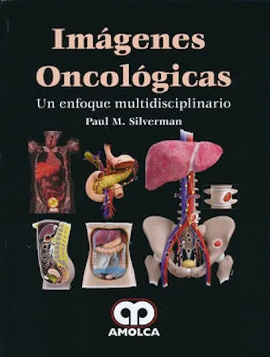 Portada de Imágenes oncológicas un enfoque multideisciplinario