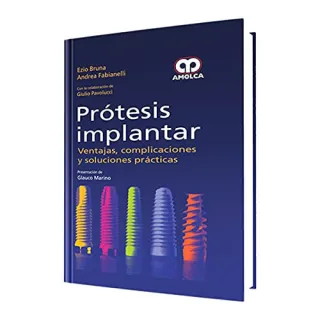 Portada de Prótesis implantar ventajas, complicaciones y soluciones prácticas