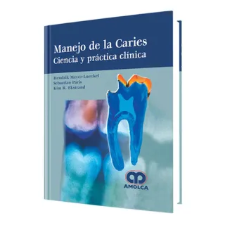 Portada de Manejo de la caries ciencia y práctica clínica