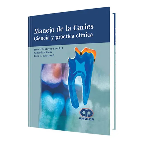 Portada de Manejo de la caries ciencia y práctica clínica