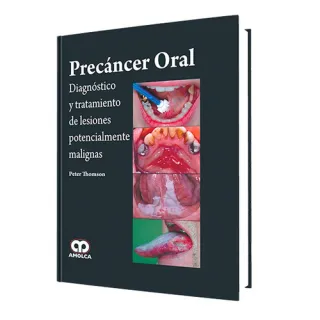 Portada de Precáncer oral Diagnóstico y tratamiento de lesiones potencialmente malignas