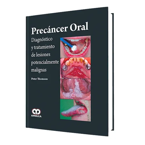 Portada de Precáncer oral Diagnóstico y tratamiento de lesiones potencialmente malignas