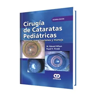 Portada de Cirugía de Cataratas Pediátricas. Segunda edición