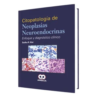 Portada de Citopatología de Neoplasias Neuroendocrinas