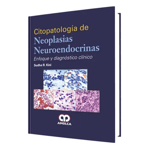 Portada de Citopatología de Neoplasias Neuroendocrinas
