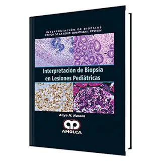 Portada de Interpretación de Biopsia en Lesiones Pediátricas