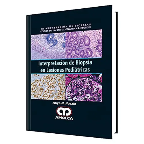 Portada de Interpretación de Biopsia en Lesiones Pediátricas