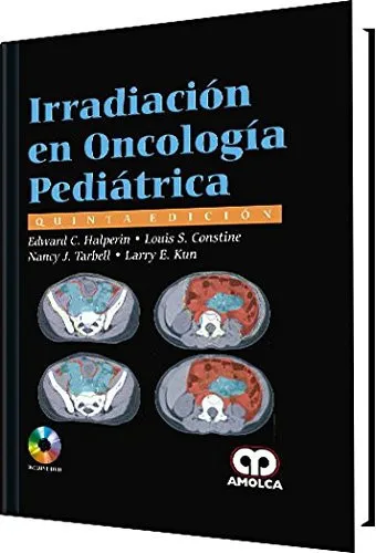 Portada de Irradiación en Oncología Pediátrica (Spanish Edition)