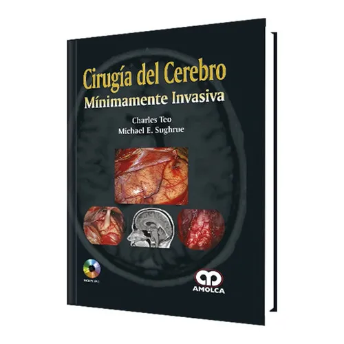 Portada de Cirugía del Cerebro Mínimamente Invasiva