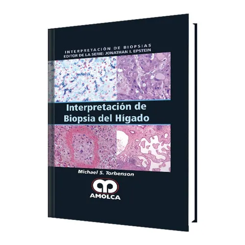 Portada de Interpretación de biopsia del hígado