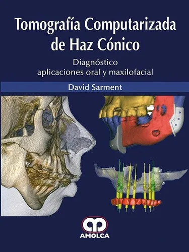 Portada de Tomografía computarizada de haz cónico diagnóstico, aplicaciones oral y maxilofacial