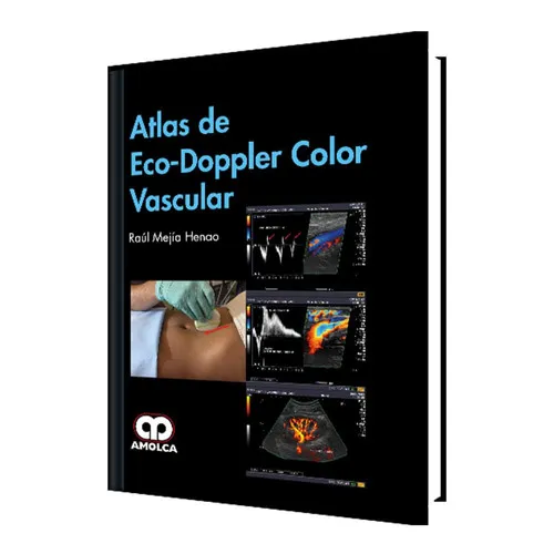 Portada de Atlas de Eco-Doppler Color Vascular (Spanish Edition)
