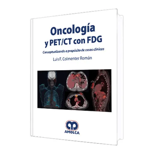 Portada de Oncología Y PET/ CT con FDG